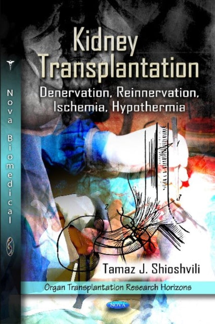 Kidney Transplantation: Denervation,