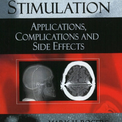 Deep Brain Stimulation: Applications, Complications & Side Effects