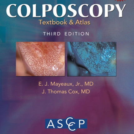 Modern Colposcopy Textbook and Atlas