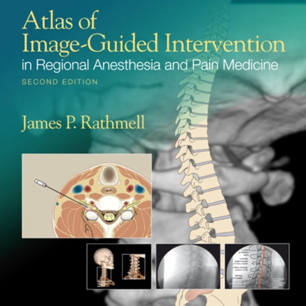 Atlas of Image-Guided Intervention in Regional Anesthesia and Pain Medicine