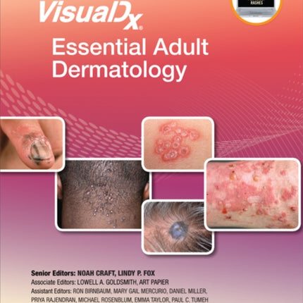 VisualDx: Essential Adult Dermatology