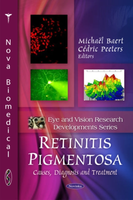 Retinitis Pigmentosa: Causes, Diagnosis & Treatment