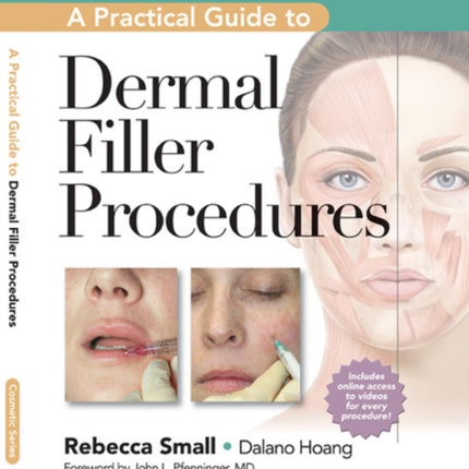 A Practical Guide to Dermal Filler Procedures