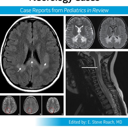 Pediatric Collections Neurology Cases Case