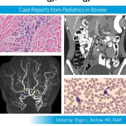Pediatric Collections HematologyOncology Cases