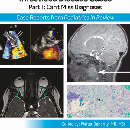 Infectious Disease Cases Part 1 Cant Miss Dia