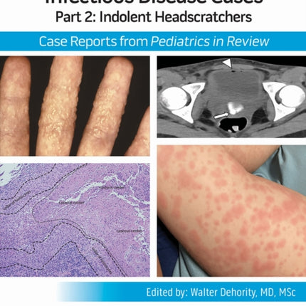 Infectious Disease Cases Part 2 Indolent Head