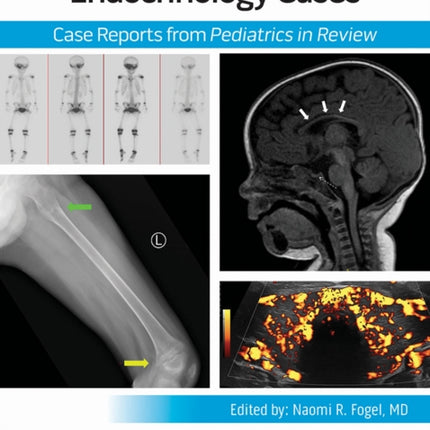 Endocrinology Cases
