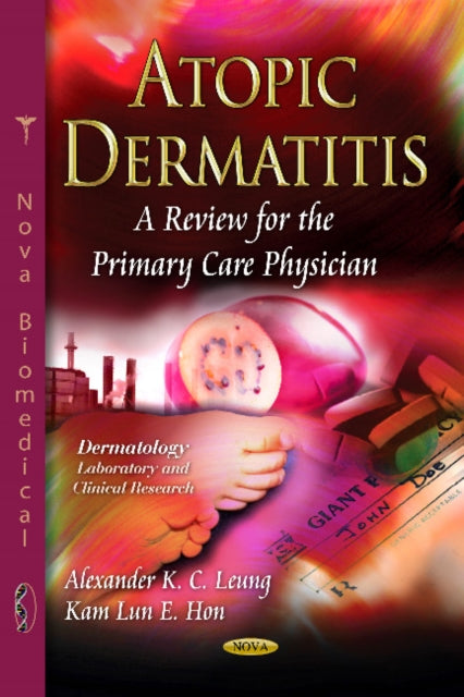 Atopic Dermatitis: A Review for the Primary Care Physician