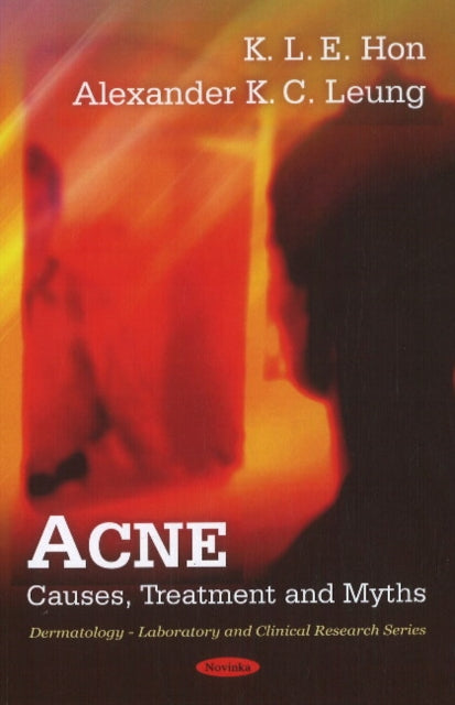 Acne: Causes, Treatment & Myths