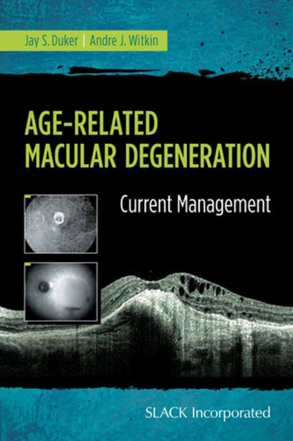 Age-Related Macular Degeneration: Current Management