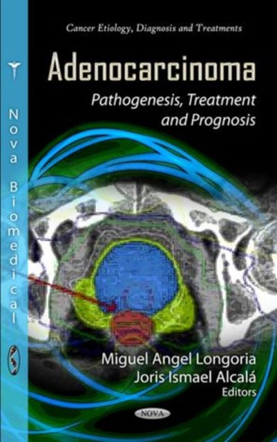 Adenocarcinoma: Pathogenesis, Treatment & Prognosis