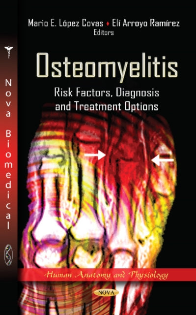 Osteomyelitis: Risk Factors, Diagnosis &