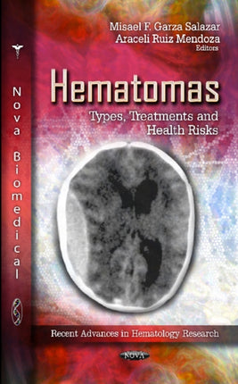 Hematomas: Types, Treatments & Health Risks