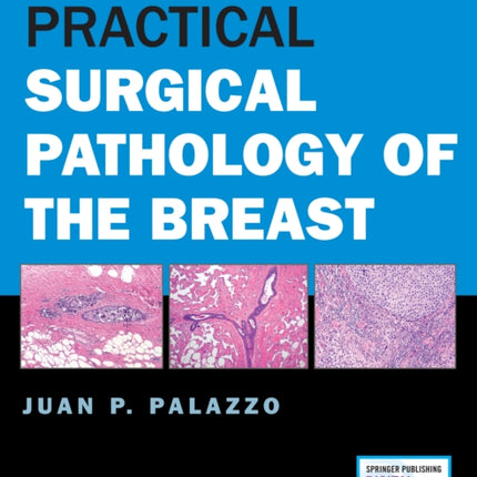 Practical Surgical Pathology of the Breast