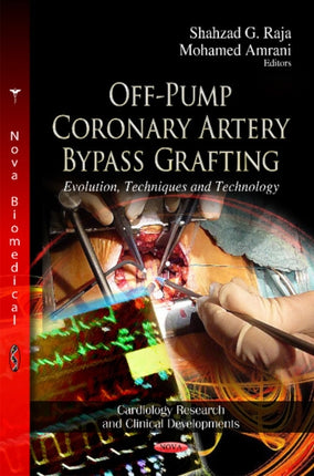 Off-Pump Coronary Artery Bypass Grafting: