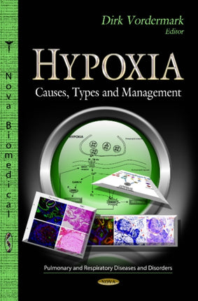 Hypoxia: Causes, Types & Management