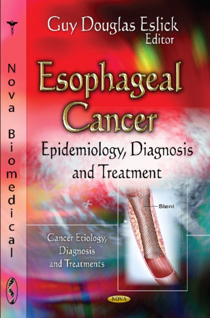 Esophageal Cancer: Epidemiology, Diagnosis & Treatment