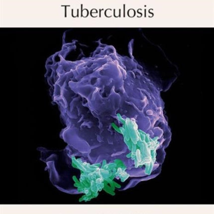 Tuberculosis Subject Collection from Cold Spring