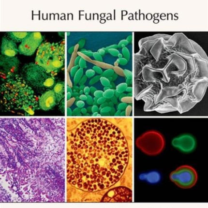 Human Fungal Pathogens