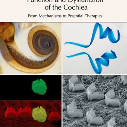 Function and Dysfunction of the Cochlea: From Mechanisms to Potential Therapies