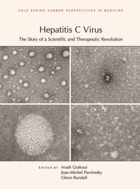 Hepatitis C Virus: The Story of a Scientific and Therapeutic Revolution