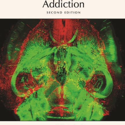 Addiction, Second Edition