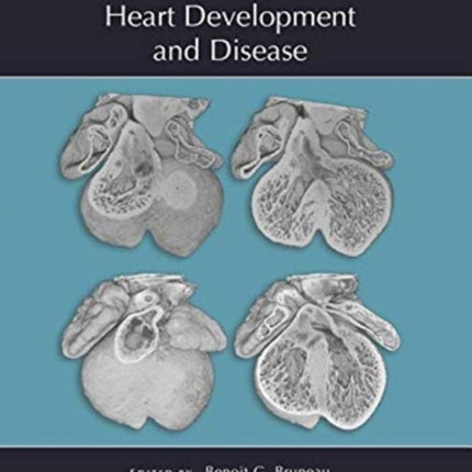 Heart Development and Disease