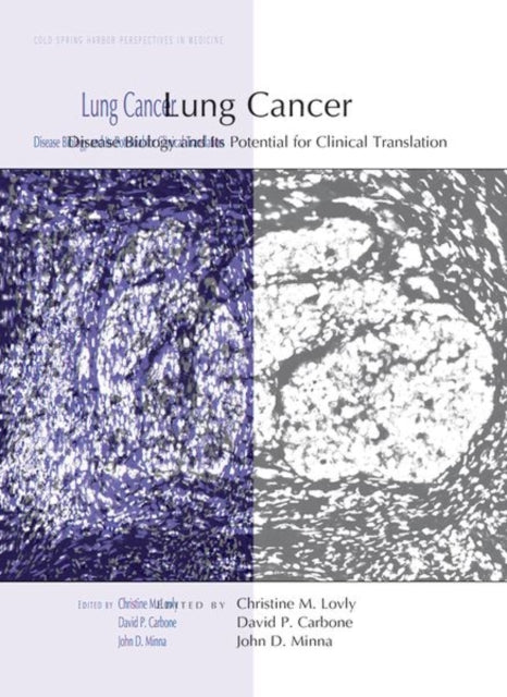 Lung Cancer: Disease Biology and Its Potential for Clinical Translation