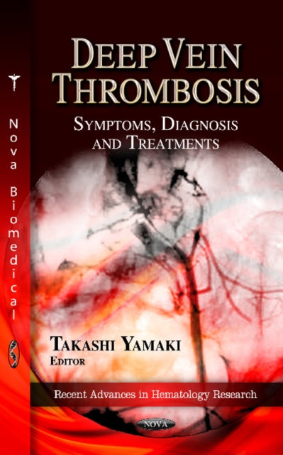 Deep Vein Thrombosis: Symptoms, Diagnosis &