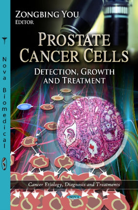 Prostate Cancer Cells: Detection, Growth &