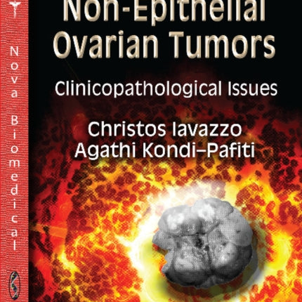 Non-Epithelial Ovarian Tumors:
