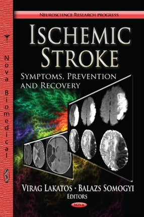 Ischemic Stroke: Symptoms, Prevention & Recovery