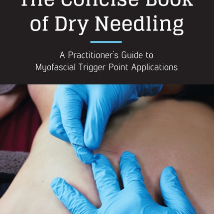 The Concise Book of Dry Needling: A Practitioner's Guide to Myofascial Trigger Point Applications