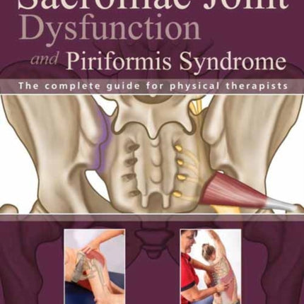 Sacroiliac Joint Dysfunction and Piriformis Syndrome: The Complete Guide for Physical Therapists