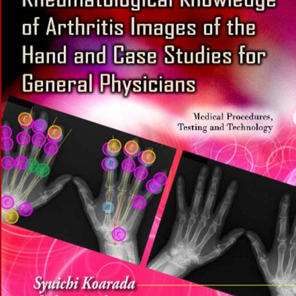 Fundamental Rheumatological Knowledge of Arthritis Images of the Hand & Case Studies for General Physicians