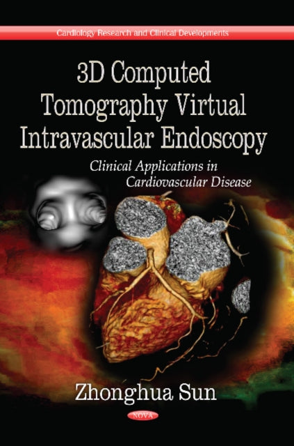 3D Computed Tomography Virtual Intravascular