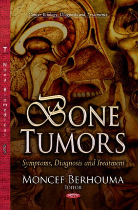 Bone Tumors: Symptoms, Diagnosis & Treatment