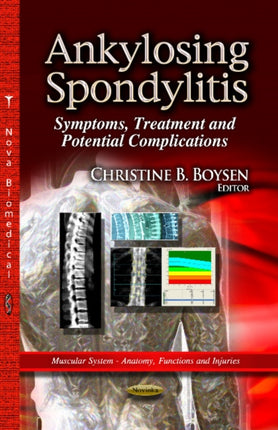 Ankylosing Spondylitis: Symptoms, Treatment & Potential Complications