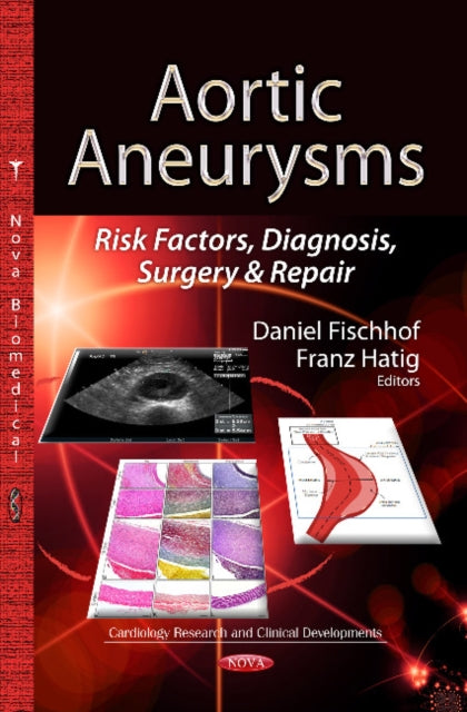 Aortic Aneurysms: Risk Factors, Diagnosis, Surgery & Repair