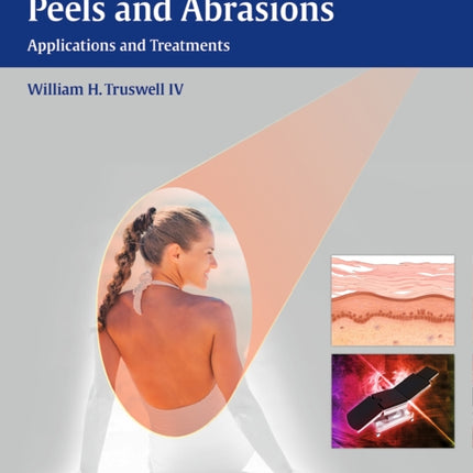 Lasers and Light, Peels and Abrasions: Applications and Treatments