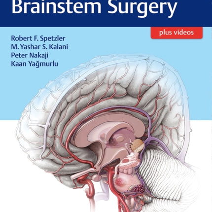 Color Atlas of Brainstem Surgery