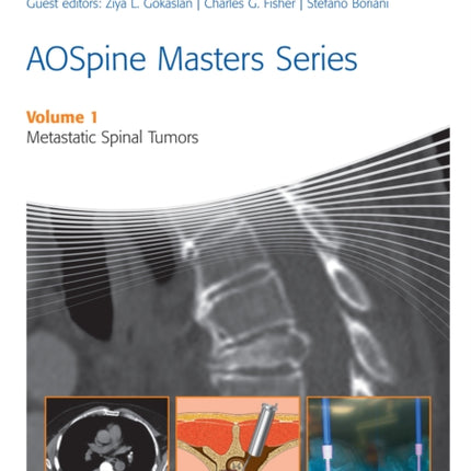 AOSpine Masters Series Volume 1: Metastatic Spinal Tumors