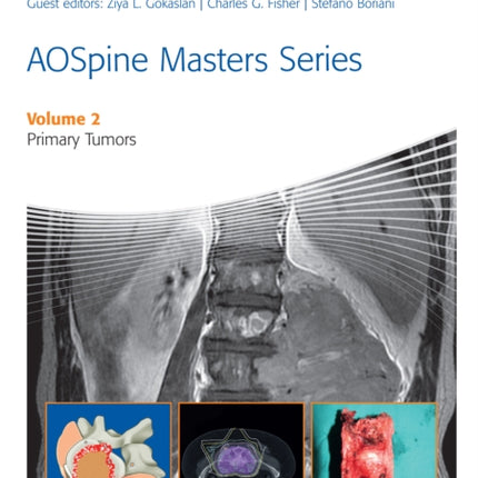 AOSpine Masters Series Volume 2: Primary Spinal Tumors