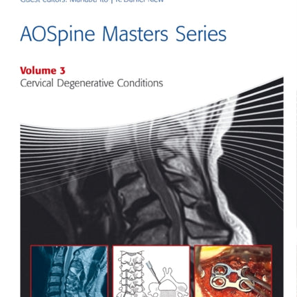 AOSpine Masters Series, Volume 3: Cervical Degenerative Conditions