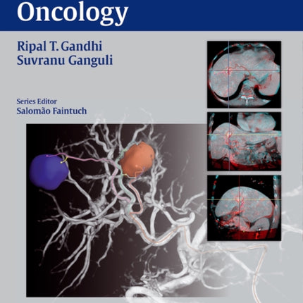 Interventional Oncology