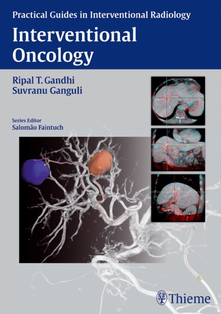 Interventional Oncology