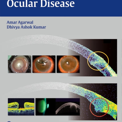 Essentials of OCT in Ocular Disease