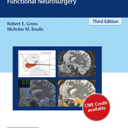 Neurosurgical Operative Atlas