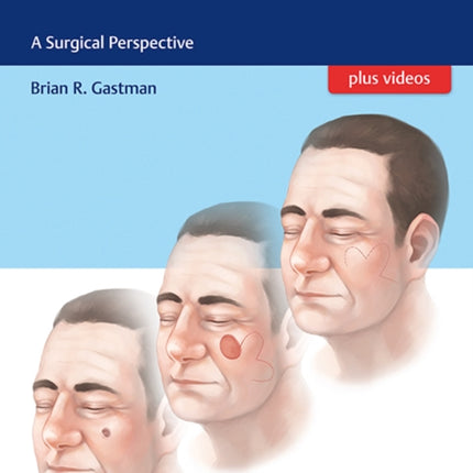 Cutaneous Malignancies